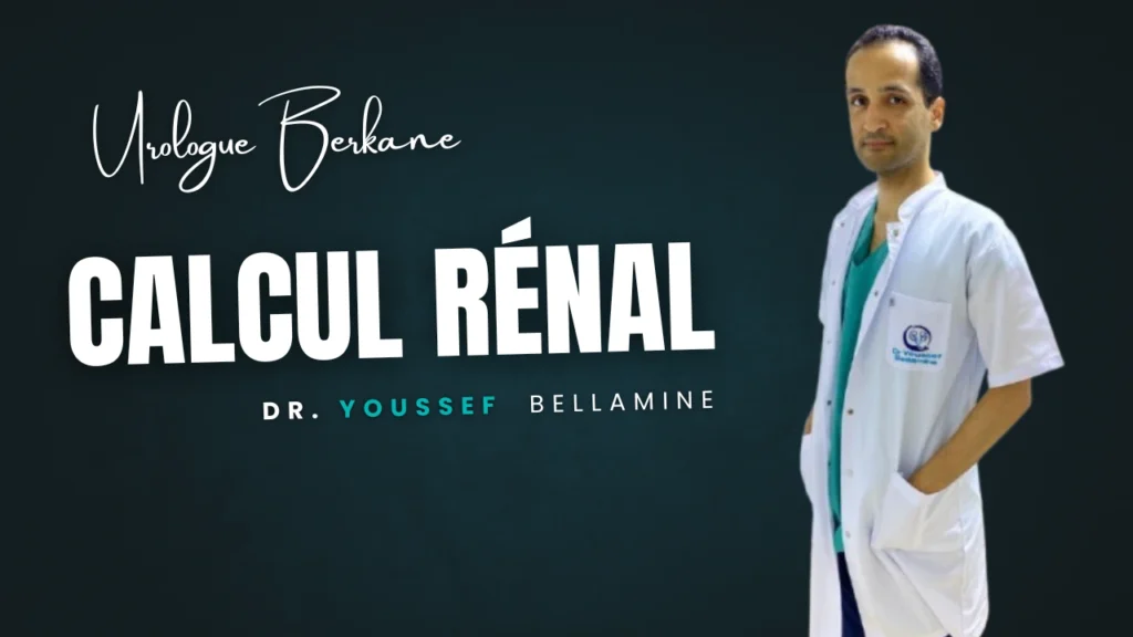 Calcul Rénal - Urologie Berkane - Dr Youssef Bellamine Urologue Berkane