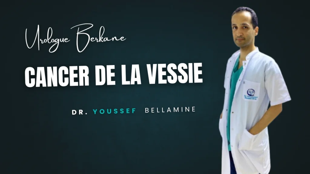 cacer de la vessie - Dr Youssef Bellamine Urologue Berkane