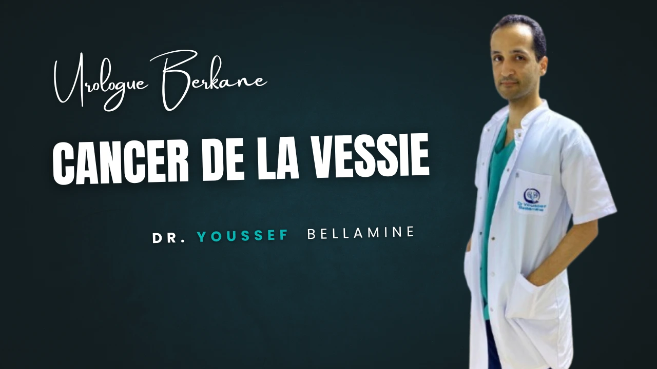 cacer de la vessie - Dr Youssef Bellamine Urologue Berkane